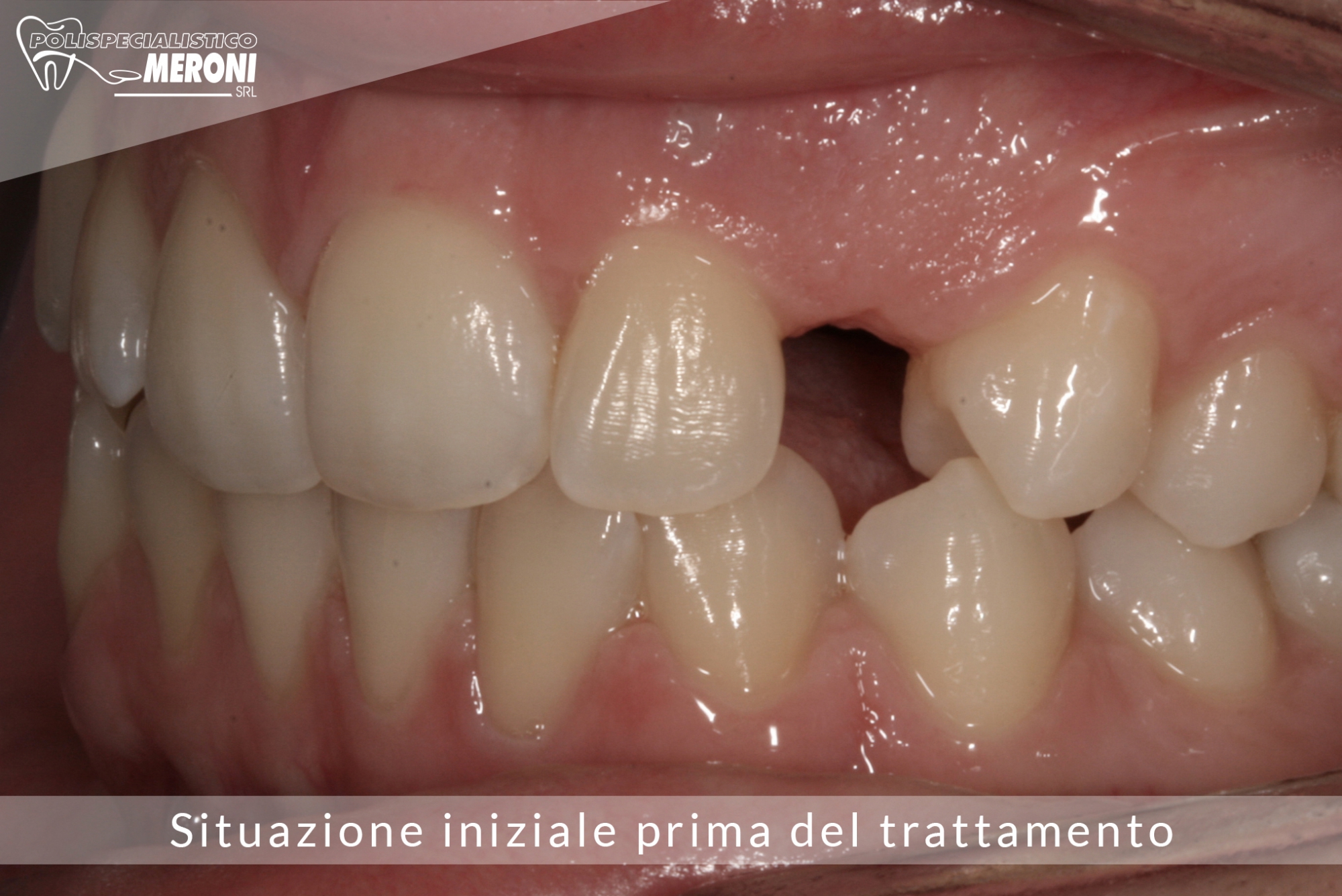 Polispecialistico Meroni, Il tuo dentista a Cantù (Como), impianti  dentali, igiene e prevenzione dentale